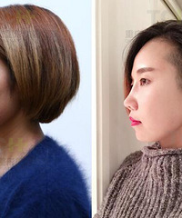 ��ʱ���ۺ�¡�ǰ����������������Ҫ�ô��֪���Ҽ�¡���ж�ţ��