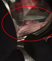 7岁小女孩因好奇心不慎卷入扶梯传送带