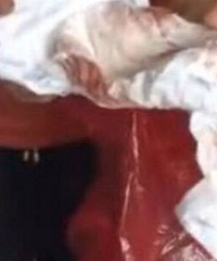 女婴疑遭性侵,尿不湿上全是血