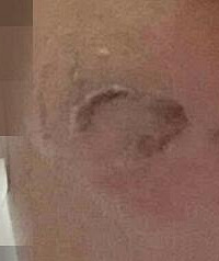 参加免费化妆,多人脸部被灼伤