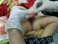 男童被狗咬掉生殖器