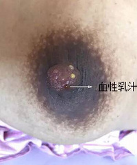 Ѫ����֭Ī�ֻţ��������ǽ�һ��