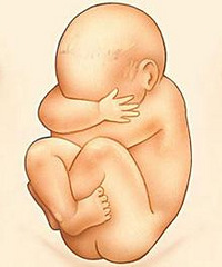 好难过!怀孕7个月被查出宝宝可能畸形,家人都劝我打掉