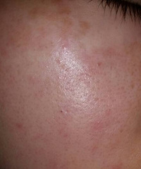 ĶƤѾٵúֲܴˣҲһ