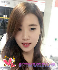 姐妹们,做内眼角手术会不会长回去呀?
