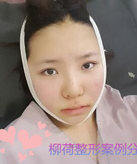 溶脂针效果能维持多久%¥注射溶脂针前后对比照片