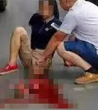 初一女生横穿公路被大货车压断腿