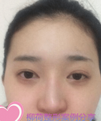 北京鼻综合手术整体价格贵吗