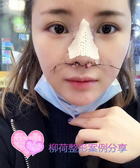 北京做鼻综合手术最好的医院