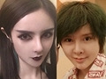 wanghong鼻祖沉珂近照惊人