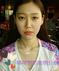 北京做骨骼手术安全吗%#骨骼手术安全吗