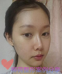 北京做骨骼手术安全吗%#骨骼手术安全吗