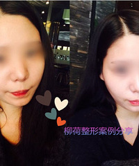 北京做全脸脂肪填充最好的医院是哪里?