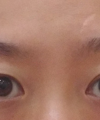 纠结多年的纹眉,今天终于拔草了!效果挺满意