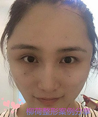 �˲������������������ɽ��������Ч�������