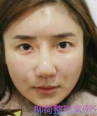 ȫ��֬����������۸�֬�������õ�ҽԺ