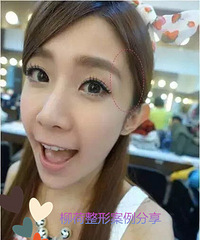 ���������̫��Ѩ����  ����ά�ֶ��߹