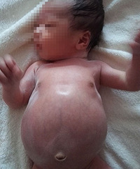 25天宝宝,肚子也太大了吧