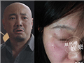 徐峥醉酒打伤女记者