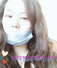 做双眼皮大概多少钱
