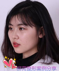 假体隆鼻与玻尿酸隆鼻的区别