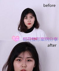 ����¡���벣����¡�ǵ�����