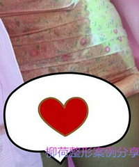 腰腹吸脂最好的医院