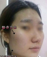 ȧ�����������ָ�ʱ��%������������õ�ҽԺ