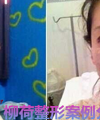 ˫��Ƥ�޸�������õ�ҽԺ%4���ۺ�����ǰ��Ա���Ƭ