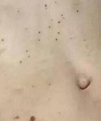 昆明3岁女童遭后妈虐死
