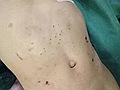 3岁女童被后妈虐死