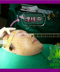 Ƥ���ɳ��´�����ν������