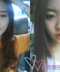 ȫ��֬����������ָ�ʱ��%��֬����������۸�