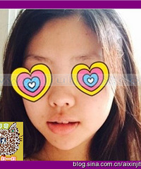 硅胶隆鼻能终生嘛