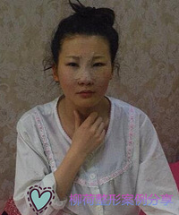 ��ʽС�̱Ǳ����ļ�ҽԺ��������