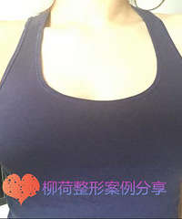 ����֬������ز�Ч������%������֬������ز��۸�