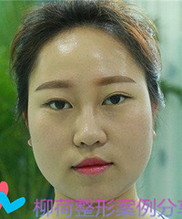 光纤溶脂手术恢复时间%4光纤溶脂手术最好的医院