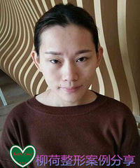 全脸脂肪填充手术价格%¥脂肪填充手术对比照片