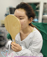 全脸脂肪填充手术价格%¥脂肪填充手术对比照片