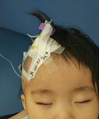 记录我家妹儿肺炎高烧治病经过
