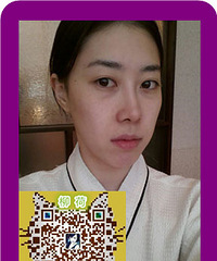 全脸脂肪填充手术安全吗