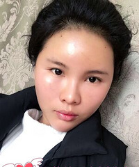 脂肪填充手术北京最好的医生