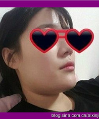 下颌角手术的价格