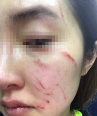 成都女子因未拴狗绳,惨遭毒打致脑震荡