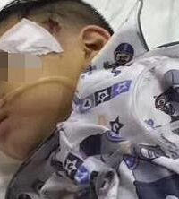 小孩被在小区被大理石砸到头了