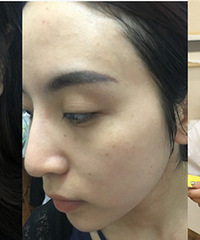 Ƥһֱܺãǰߣȥߣһξ͵˺ܶ