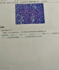 �ʸ�˹ϸ����֯����