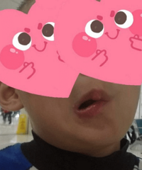 小孩被打成面瘫,大小便失禁