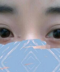 因为双眼皮我感到很苦恼