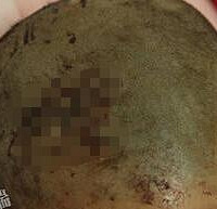 5岁男童被藏獒扑倒咬缝了38针